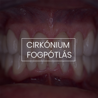 Divusdent - Fogászat, Fogorvos Nyíregyháza