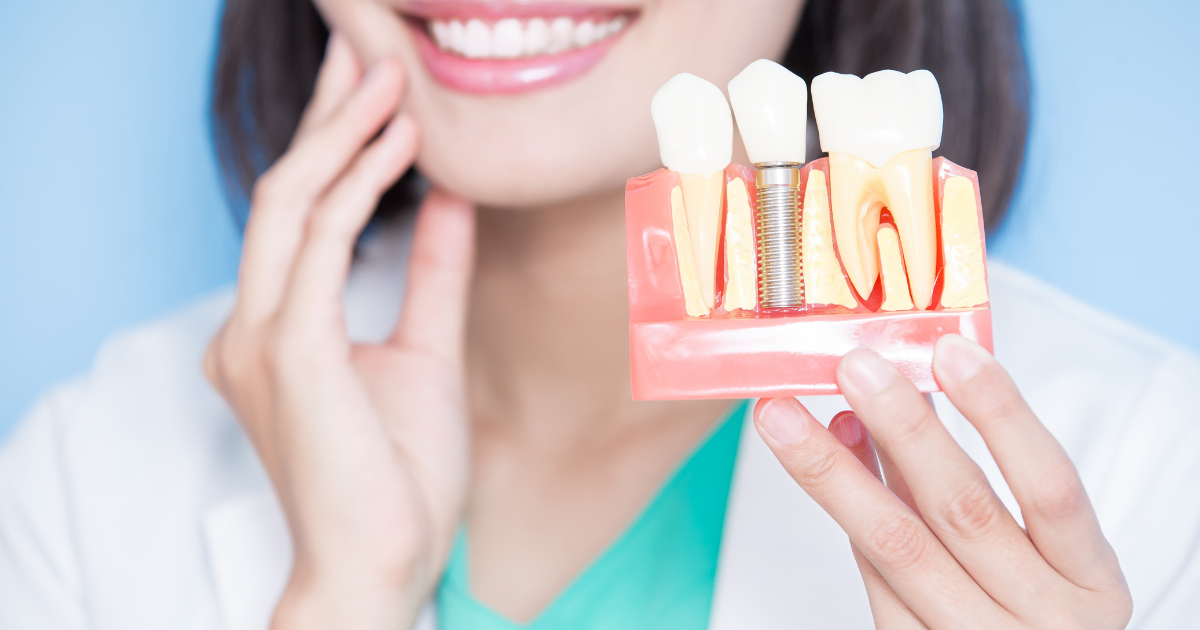 A fogászati implantátum kilökődésének tünetei és okai